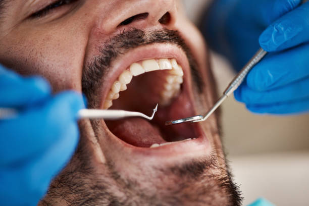 Best Emergency Dental Care for Broken or Chipped Teeth in Independence, IA